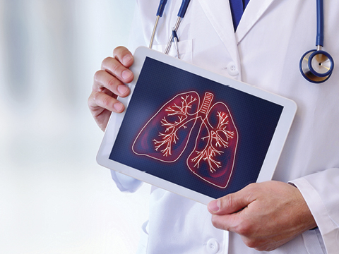 Doctor showing lungs on an ipad