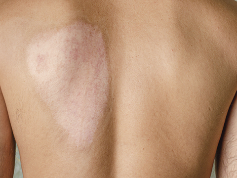 05258 skinflaps grafts1 480