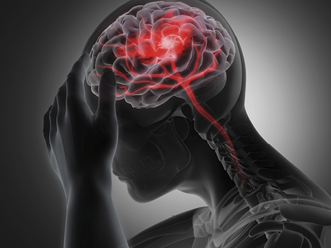 brain injury illustration