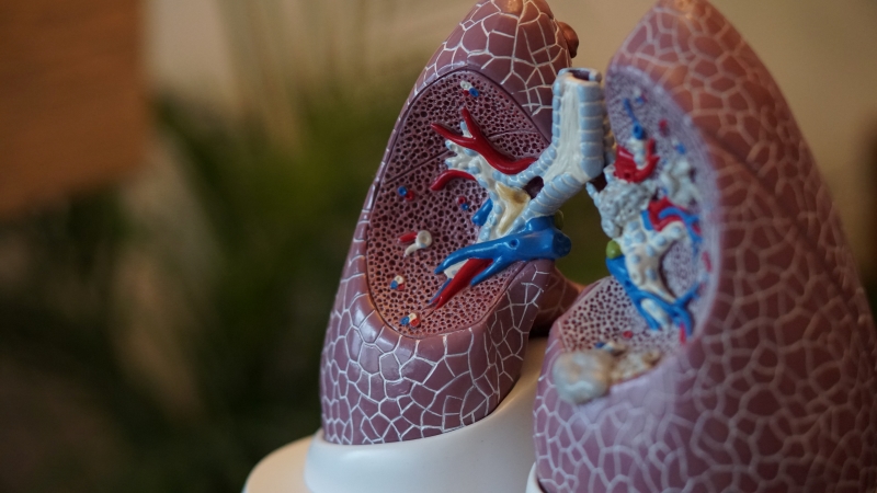 3D model of the lungs
