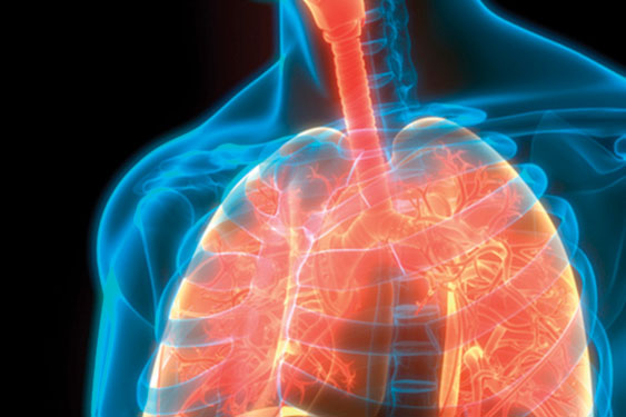 emphysema illustration