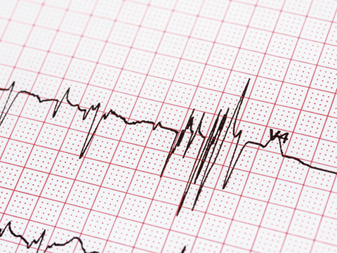 Cardiac Monitoring